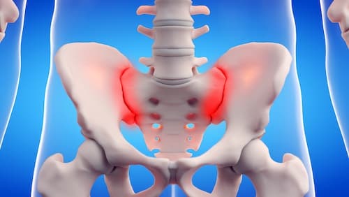 SI Joint Treatment